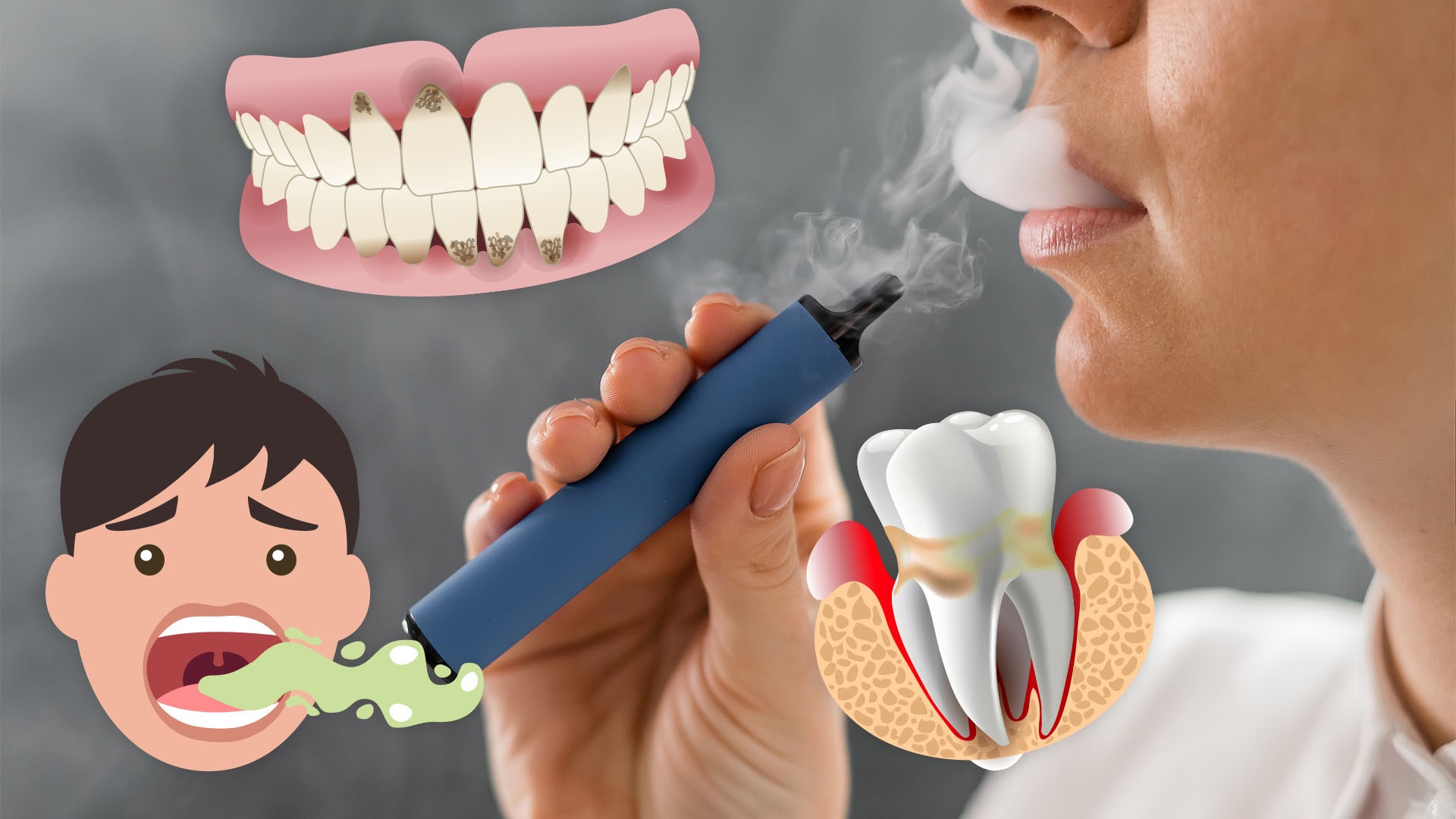 Vaping: Your Teeth's New Worst Enemy?